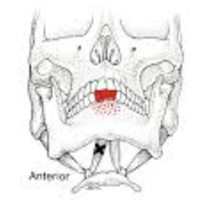 Anterior digastric toothache referral